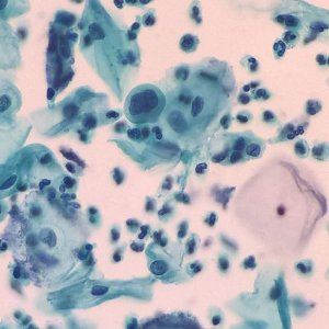 citopatologia-1594837431 Citopatologia